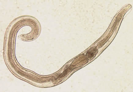 enterobius